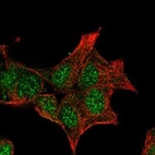 Anti-GCKR Antibody