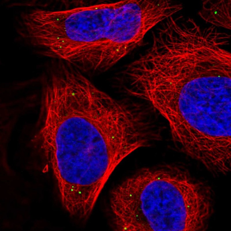 Rabbit Polyclonal Anti-SEMA3A Antibody - Buy for research - Highly ...