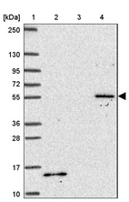 Lane 1: Marker [kDa] 250, 130, 95, 72, 55, 36, 28, 17, 10_br/_Lane 2: Human cell line RT-4_br/_Lane 3: Human cell line U-251MG sp_br/_Lane 4: Human plasma (IgG/HSA depleted)