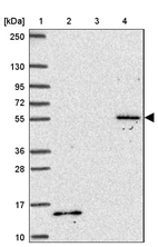 Lane 1: Marker [kDa] 250, 130, 95, 72, 55, 36, 28, 17, 10_br/_Lane 2: Human cell line RT-4_br/_Lane 3: Human cell line U-251MG sp_br/_Lane 4: Human plasma (IgG/HSA depleted)