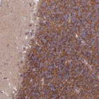 Anti-TTLL7 Antibody