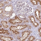 Anti-PIK3R5 Antibody