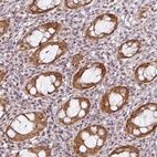 Anti-C1orf226 Antibody
