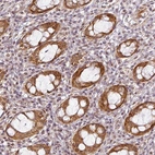 Anti-C1orf226 Antibody