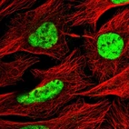 Immunofluorescent staining of human cell line U-2 OS shows localization to nucleoplasm.
