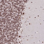 Anti-TDG Antibody