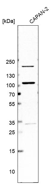 Anti-PIBF1 Antibody