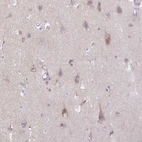 Anti-SLC38A1 Antibody