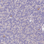 Anti-SLC38A1 Antibody