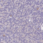 Immunohistochemical staining of human cerebellum shows moderate cytoplasmic positivity in subset of cells in granular layer.
