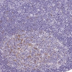 Immunohistochemical staining of human lymph node shows moderate membranous positivity in germinal center cells.