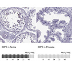 Anti-OIP5 Antibody