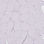 Immunohistochemical staining of human skeletal muscle shows no positivity in myocytes as expected.