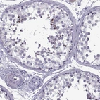 Immunohistochemical staining of human testis shows strong positivity in acrosomes.