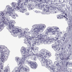 Anti-OIP5 Antibody