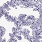 Immunohistochemical staining of human prostate shows no positivity in glandular cells as expected.