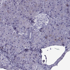 Anti-OIP5 Antibody