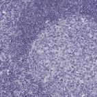 Anti-OIP5 Antibody