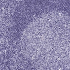 Immunohistochemical staining of human tonsil shows no positivity in germinal center cells as expected.