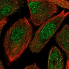 Immunofluorescent staining of human cell line PC-3 shows localization to nucleoplasm & cytosol.