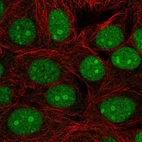 Immunofluorescent staining of human cell line MCF7 shows localization to nucleus & nucleoli.