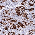 Anti-RIPPLY1 Antibody