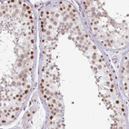 Immunohistochemical staining of human testis shows strong nuclear positivity in cells in seminiferous ducts.
