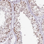 Immunohistochemical staining of human testis shows strong nuclear positivity in cells in seminiferous ducts.