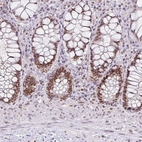 Immunohistochemical staining of human gastrointestinal shows moderate nuclear positivity in glandular cells.