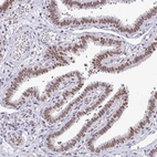Immunohistochemical staining of human fallopian tube shows moderate nuclear positivity in glandular cells.