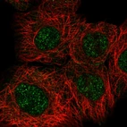 Immunofluorescent staining of human cell line A-431 shows localization to nucleoplasm.