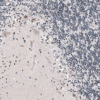 Immunohistochemical staining of human cerebellum shows weak to moderate nuclear positivity in Purkinje cells.