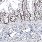 Immunohistochemical staining of human upper gastrointestinal shows moderate nuclear positivity in glandular cells.