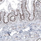 Immunohistochemical staining of human upper gastrointestinal shows moderate nuclear positivity in glandular cells.