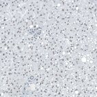 Immunohistochemical staining of human liver shows very weak nuclear positivity in hepatocytes.