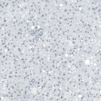 Immunohistochemical staining of human liver shows very weak nuclear positivity in hepatocytes.