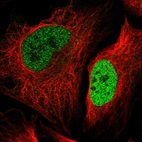 Immunofluorescent staining of human cell line U-2 OS shows localization to nucleoplasm.