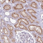 Anti-ABCC5 Antibody
