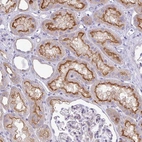 Anti-ABCC5 Antibody