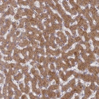 Anti-G6PC Antibody