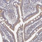Immunohistochemical staining of human duodenum shows moderate cytoplasmic positivity in glandular cells.
