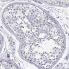 Immunohistochemical staining of human testis shows no cytoplasmic positivity in cells in seminiferous ducts as expected.