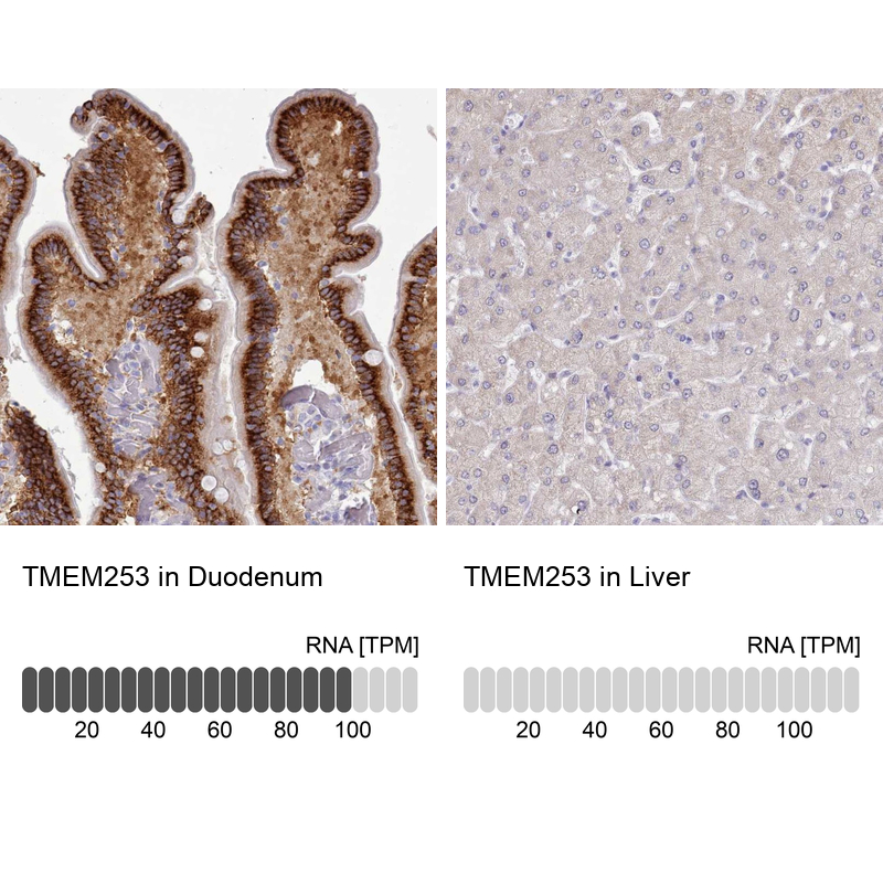 Anti-TMEM253 Antibody