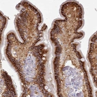Immunohistochemical staining of human duodenum shows high expression.