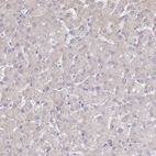 Immunohistochemical staining of human liver shows low expression as expected.