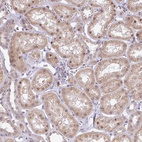 Anti-FAM153A Antibody