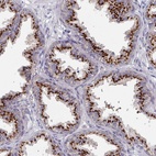 Anti-EFL1 Antibody