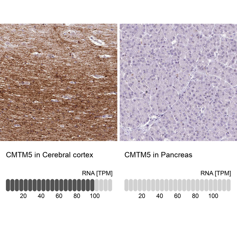Anti-CMTM5 Antibody