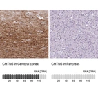 Anti-CMTM5 Antibody