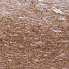 Immunohistochemical staining of human cerebral cortex shows strong positivity in neuronal processes in neuropil.